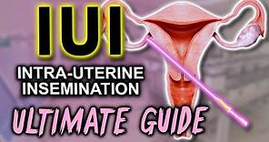 IUI - Fertility expert secrets for maximum pregnancy rates