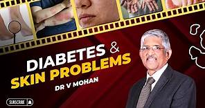 Diabetes and Skin Problems | Dr V Mohan
