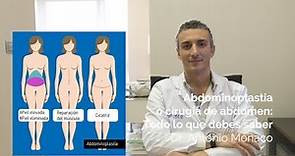 Dr. Antonio Mónaco | Cirugía de abdomen o abdominoplastia: lo que debes saber | IMED Levante y Elche