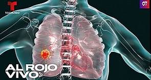 Cáncer de pulmón: 8 síntomas que todo el mundo debería conocer