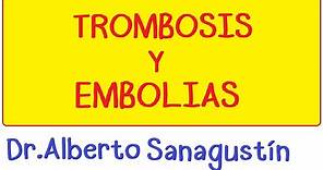 TROMBOSIS y EMBOLIA ¿Qué son? #vascular