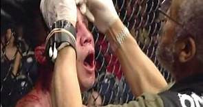 UFC 180 BJ Penn VS joe stevenson