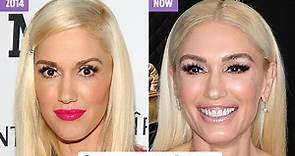 Gwen Stefani, 50, accused of getting plastic surgery as she looks 'unrecognizable' at the Grammys