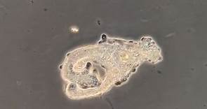 Amoeba Eating | Microscopic Monday