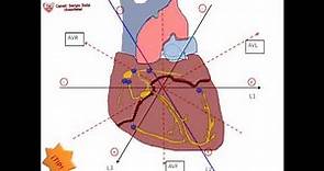 2.La forma mas sencilla de sacar eje cardiaco, Ordenando el Triangulo de Einthoven