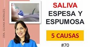 😱5 causas de SALIVA ESPESA, blanca y espumosa👉Episodio 70.