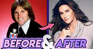 Caitlyn Jenner | Before and After Transformations | Plastic Surgery Bruce to Caitlyn