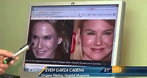 Las Noticias - Renee Zellweger cambia su rostro con más de una cirugía