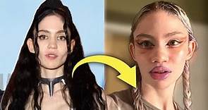 Grimes Admits to Plastic Surgery: Is this the Start of the New Transparency Era?