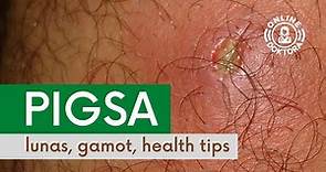 PIGSA: Lunas, Gamot at Health Tips | Anong Dapat Gawin Kapag May Pigsa o Boil?