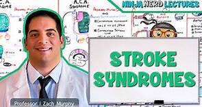 Stroke Syndromes: MCA, ACA, ICA, PCA, Vertebrobasilar Artery Strokes | Pathophysiology