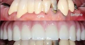 牙齒保健的重要貼士