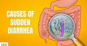 Causes of Sudden Diarrhea