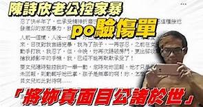 【再反擊】陳詩欣老公控家暴po驗傷單 「將妳真面目公諸於世」 | 台灣蘋果日報