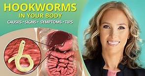 Hookworms | Causes, Signs, Symptoms, & Tips #parasites | Dr. J9 Live