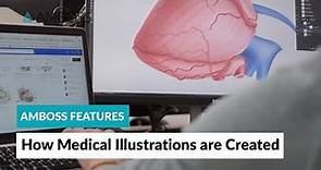 AMBOSS Features: How Medical Illustrations are Created