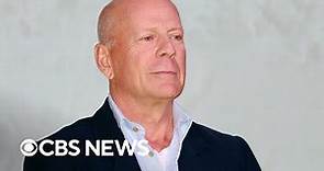 What is aphasia? Bruce Willis diagnosed with condition that affects communication