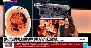 La historia del cáncer: miles de años de convivencia y lucha contra la enfermedad • FRANCE 24