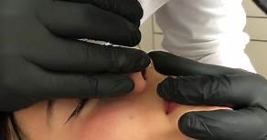 estudio 184 piercing & custom tattoo Perforación en #septum hecha por @themonster_piercing_izcoatl #estudio184 #estudio184roma #izcoatlmonrroy #safepiercing #propiercer #septumpiercing #altagama #titaniogradoimplante #perforaciones #perforadoresmexicanos #piercing #cdmx | estudio184 piercing & tattoo