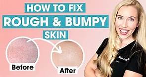How To Fix Rough and Bumpy Skin | Keratosis Pilaris Affordable Skincare Routine
