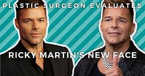 RICKY MARTIN'S NEW FACE: Did Ricky Martin Have Plastic Surgery? Plastic Surgeon Evaluates.