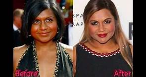 Mindy Kaling before and after plastic surgery