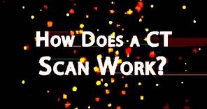 How does a CT work || CT scan working || computed tomography ||#xray #ctscane #@Radiographer.2024