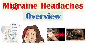 Migraine Headache (Overview) | Pathophysiology, Triggers, Phases, Symptoms, Diagnosis, Treatment