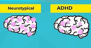 Infographics: What is ADHD?