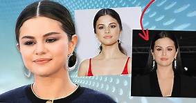 The Complicated Reason Selena Gomez's Face Looks So Different Now Proves Why We Need To Stop Commenting On People's Looks
