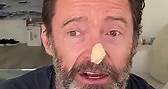 Hugh Jackman cancer scare: Wolverine star undergoes two biopsies