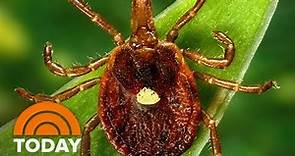 How A Bite From A 'Lone Star' Tick Can Trigger Severe Allergy To Meat
