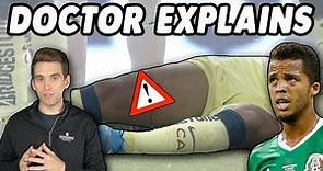 Doctor's Guide to Giovani Dos Santos Leg Injury | A Hole in His Leg??