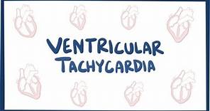 Ventricular tachycardia (VT) - causes, symptoms, diagnosis, treatment & pathology