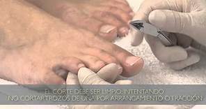 Cómo cortar las uñas de los pies correctamente : Tips para pedicuría