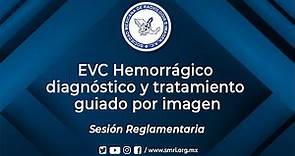 Sesión Reglamentaria: EVC Hemorrágico diagnóstico y tratamiento guiado por imagen