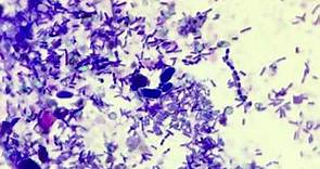 Cyniclomyces guttulatus in fecal cytology