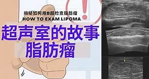 脂肪瘤：身上长了小肿块 不疼不痒是怎么回事？ 脂肪瘤是什么/为什么会得这个病/危险人群/典型症状/B超是如何检查脂肪瘤的/预防和治疗方法【Ultrasound Room】Lipoma