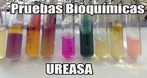 Ureasa Pruebas Bioquímicas