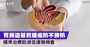 【健康增值】胃腸道基質腫瘤防不勝防　精準治療助減低復發機會 - 香港經濟日報 - 理財 - 個人增值