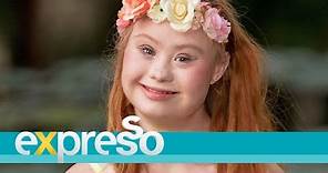Model Madeline Stuart living with Down Syndrome