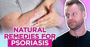 How to Get Rid of Psoriasis – Natural Remedies for Psoriasis