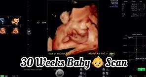 30 Weeks Pregnancy Baby Scan (Ultrasound) Movement