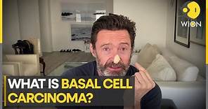 Hugh Jackman reveals new skin cancer scare, says 'please wear sunscreen, it's not worth it' | WION