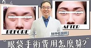 【美貌知尋識EP.16眼袋費用如何計算？】整外醫師執刀，永久告別眼袋困擾！#眼袋手術 #台北整形外科