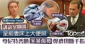 【對簿公堂】誹謗案開審呈前妻床上大便照　尊尼特普晒家暴傷勢爆遭切斷手指 - 香港經濟日報 - TOPick - 親子 - 親子資訊