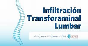 Clínica de la Columna - Infiltración Transforaminal Lumbar - Dr. Santana