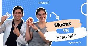 Diferencias entre Moons y Brackets | ¿Qué tratamiento elegir? 👀