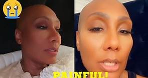 🚩 Towanda Braxton explains how she lost her hair to baldness, painful 😭😭. Tracy is involved