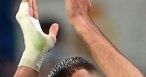 ¿Por que Benzema se venda la mano?